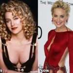 Sharon Stone before and after plastic surgery (39)