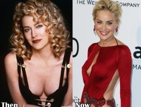 Sharon Stone before and after plastic surgery (39)