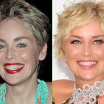Sharon Stone before and after plastic surgery (42)
