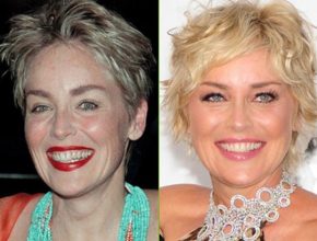 Sharon Stone before and after plastic surgery (42)