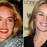 Sharon Stone before and after plastic surgery (43)