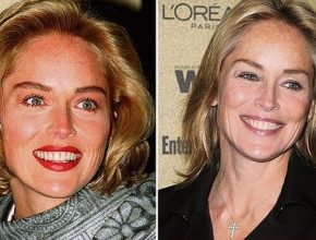 Sharon Stone before and after plastic surgery (43)