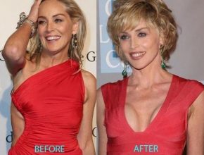 Sharon Stone plastic surgery (36)