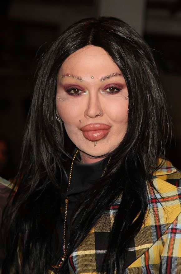 pete-burns-after-plastic-surgery