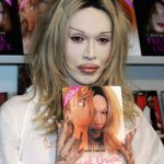 Pete Burns after plastic surgery 32