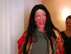 Pete Burns after plastic surgery 7