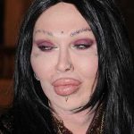 Pete Burns after plastic surgery 8