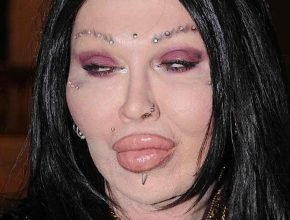 Pete Burns after plastic surgery 8