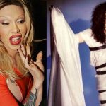 Pete Burns before and after plastic surgery 1