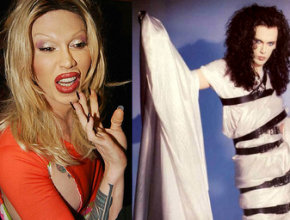 Pete Burns before and after plastic surgery 1