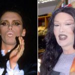 Pete Burns before and after plastic surgery 38
