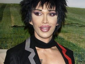 Pete Burns plastic surgery 10