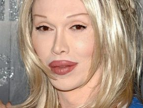 Pete Burns plastic surgery 11