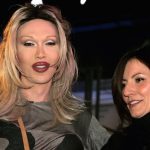 Pete Burns plastic surgery 16