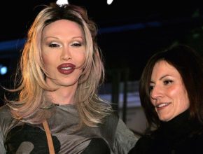 Pete Burns plastic surgery 16