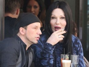 Pete Burns plastic surgery 17