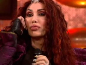 Pete Burns plastic surgery 25