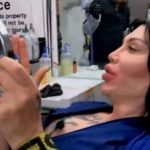 Pete Burns plastic surgery 26