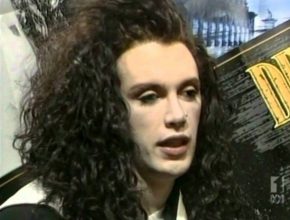 Pete Burns plastic surgery 28