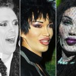 Pete Burns plastic surgery 29