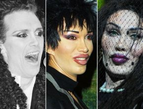 Pete Burns plastic surgery 29