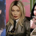 Pete Burns plastic surgery 31