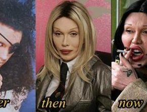 Pete Burns plastic surgery 31