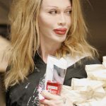 Pete Burns plastic surgery 34