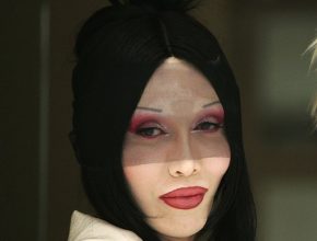 Pete Burns plastic surgery 36