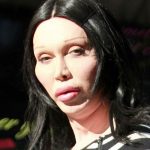 Pete Burns plastic surgery 37