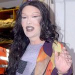 Pete Burns plastic surgery 39