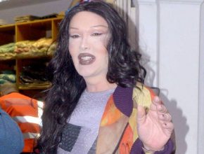 Pete Burns plastic surgery 39