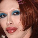 Pete Burns plastic surgery 40