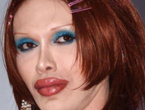 Pete Burns plastic surgery 40