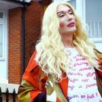 Pete Burns plastic surgery 5