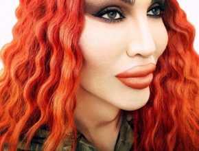 Pete Burns plastic surgery 50