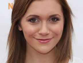 Alyson Stoner after nose job 24