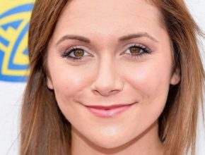 Alyson Stoner after nose job 25