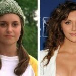 Alyson Stoner before and after plastic surgery 9
