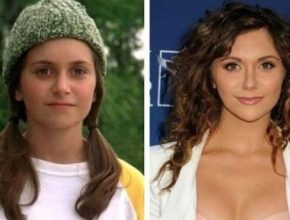 Alyson Stoner before and after plastic surgery 9