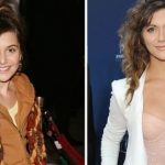 Alyson Stoner before and after plastic surgery 20
