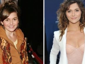Alyson Stoner before and after plastic surgery 20