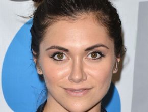 Alyson Stoner plastic surgery 23