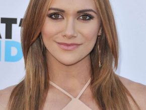 Alyson Stoner plastic surgery 29