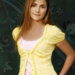 Alyson Stoner plastic surgery 3