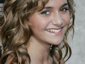 Alyson Stoner plastic surgery 5