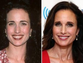 Andie Macdowell before and after plastic surgery 21