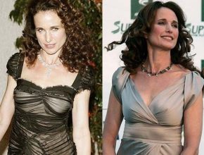 Andie Macdowell before and after plastic surgery 25
