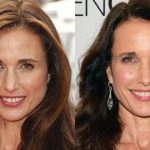 Andie Macdowell before and after plastic surgery 28