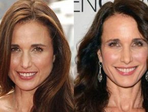 Andie Macdowell before and after plastic surgery 28